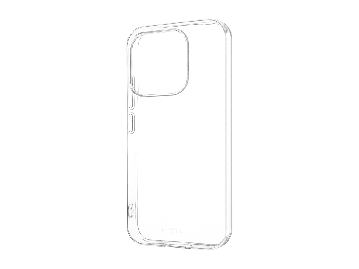 Fixed Story AntiUV | Back cover | Xiaomi | 17 | TPU | Clear